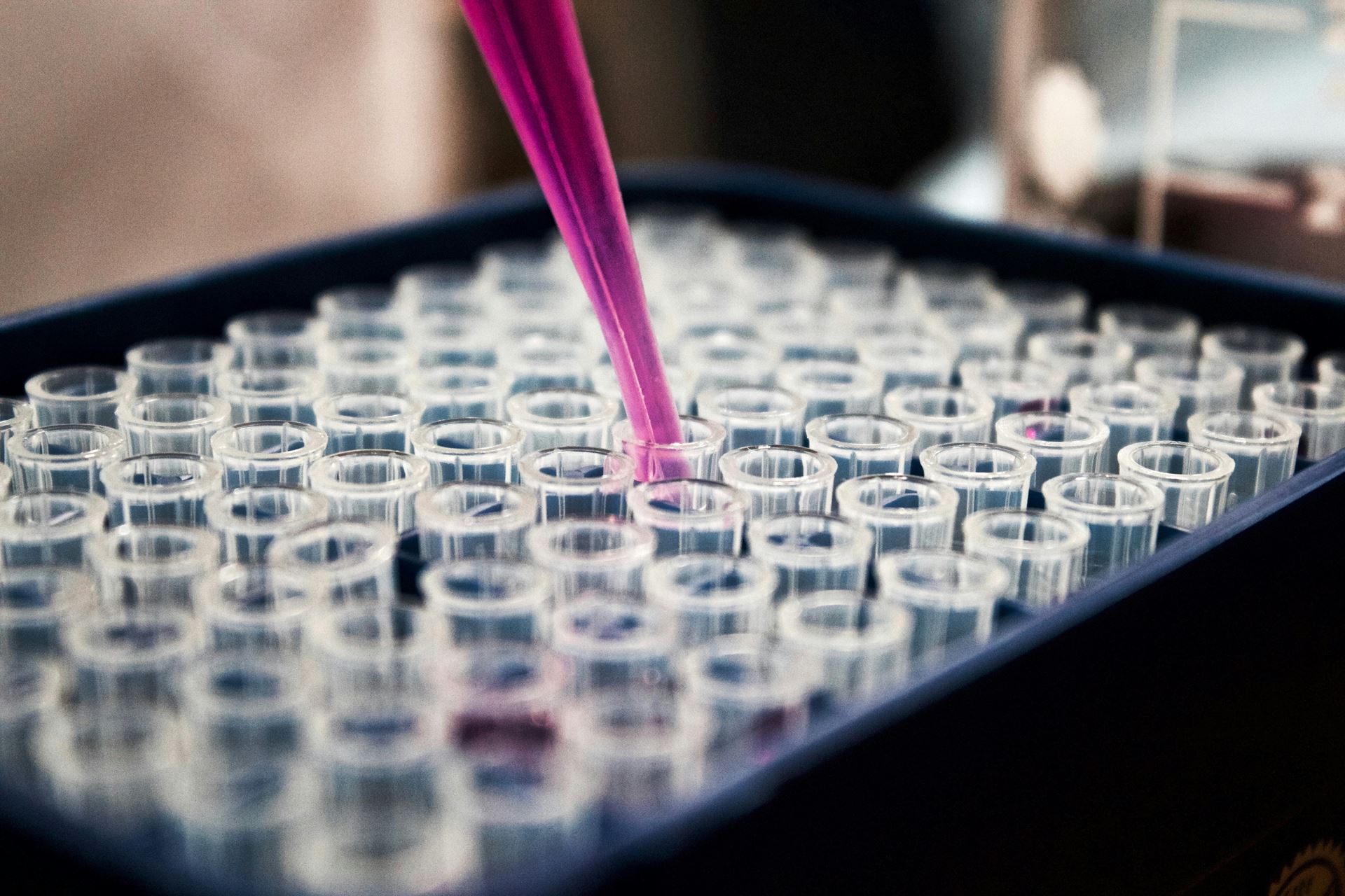 smear test